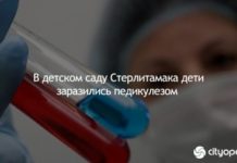 В детском саду Стерлитамака дети заразились педикулезом
