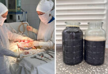 В Стерлитамаке спасли женщину с восьмилитровой кистой