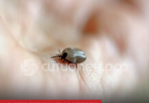 В Стерлитамаке за неделю зафиксировали 12 укусов клещей